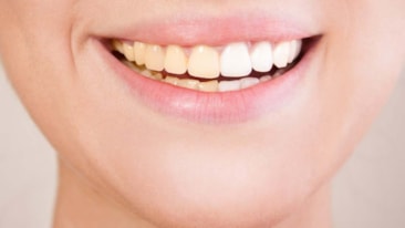 Uzmanı uyardı: Diş sağlığı üzerinde olumsuz etkisi olabilir