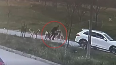 Oğlunu köpeklerden korumak isterken elleri ve kulağı parçalandı