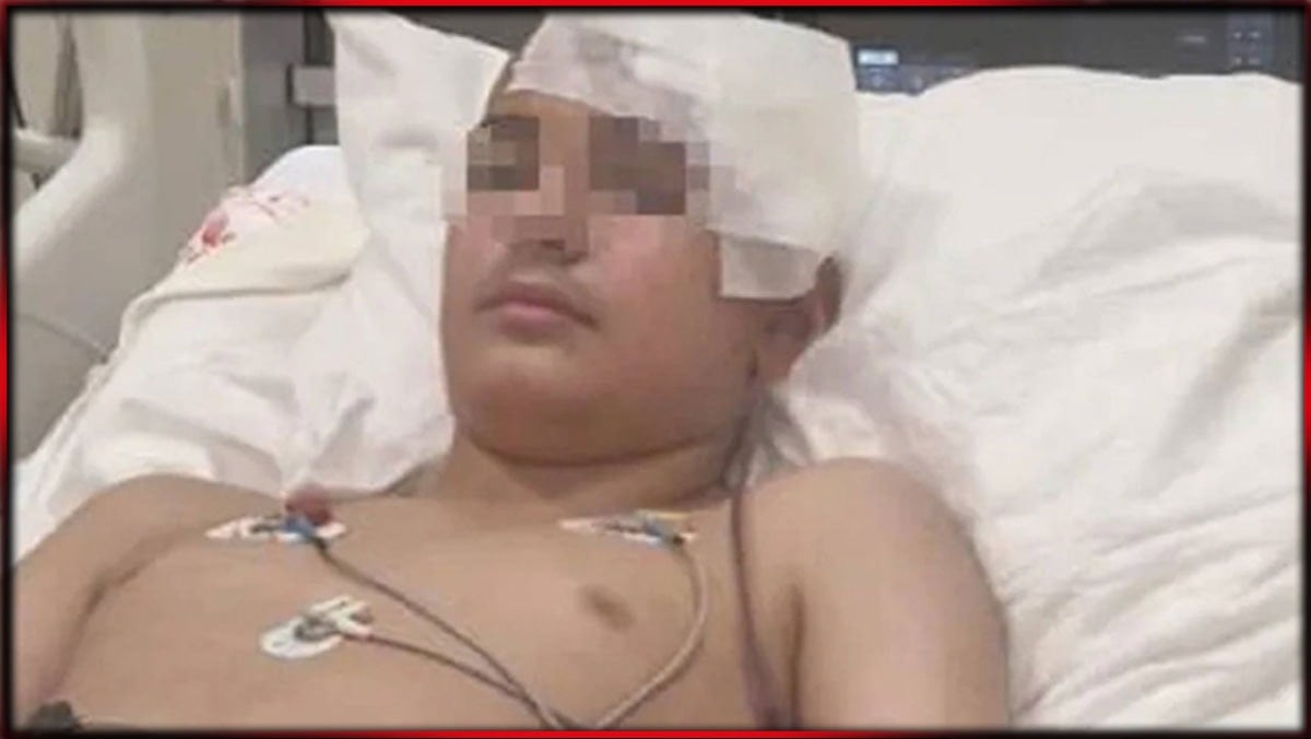 Akran şiddeti komalık etti! 13 yaşındaki çocuğun kafatası titanyumla yeniden yapıldı