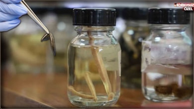 İktidarın bulduğu çare ‘kan emmek’ oldu: Sağlığa sülük yapıştı!