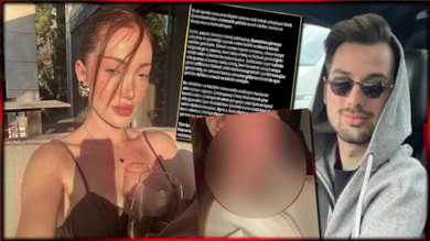 Danla Bilic, eski sevgilisi tarafından darp edildi