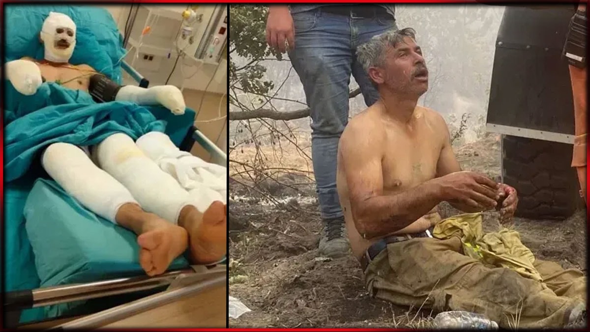 “Yanıyorum” feryadıyla hafızalara kazınmıştı: Orman yangınında ağır yaralanan işçinin son hali..