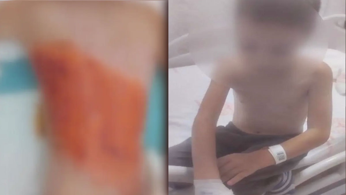 İstanbul'da dehşet! 12 yaşındaki çocuk arkadaşları tarafından diri diri yakıldı