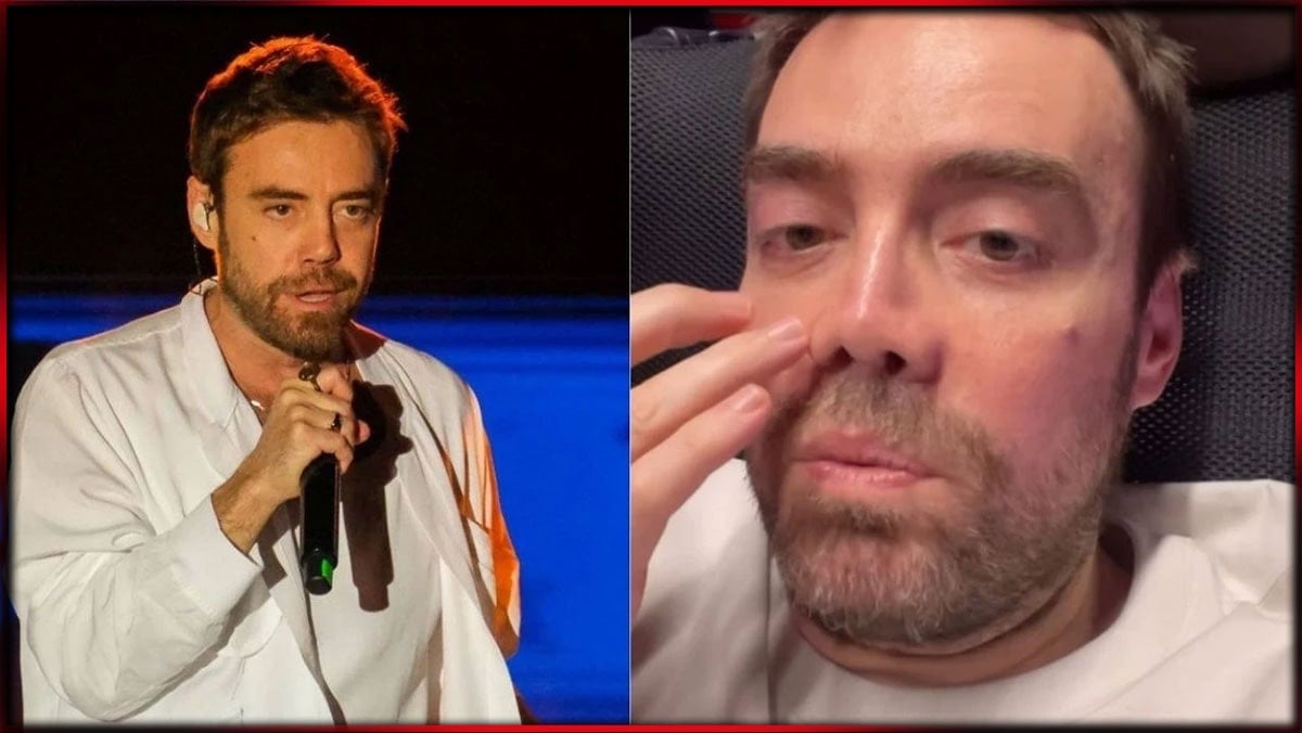 13’üncü kez ameliyatı oldu.. Murat Dalkılıç burnunun son halini paylaştı