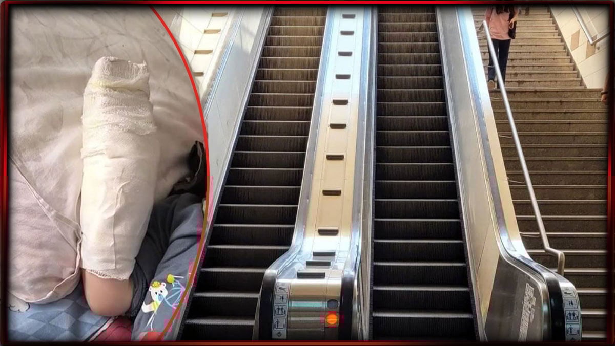 AVM'de yürüyen merdiven dehşeti: Küçük çocuğun kopan parmağı kurtarılamadı