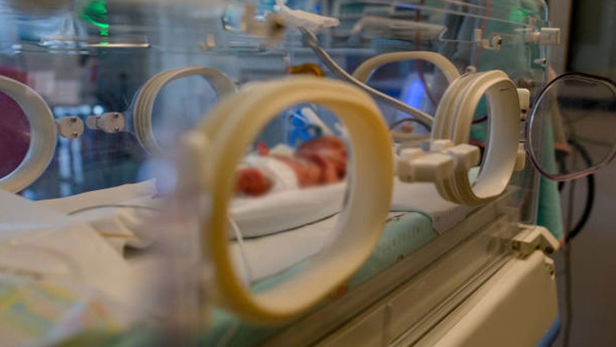 İstanbul'da skandal ihmal: 17 günlük bebek küvözde yandı!