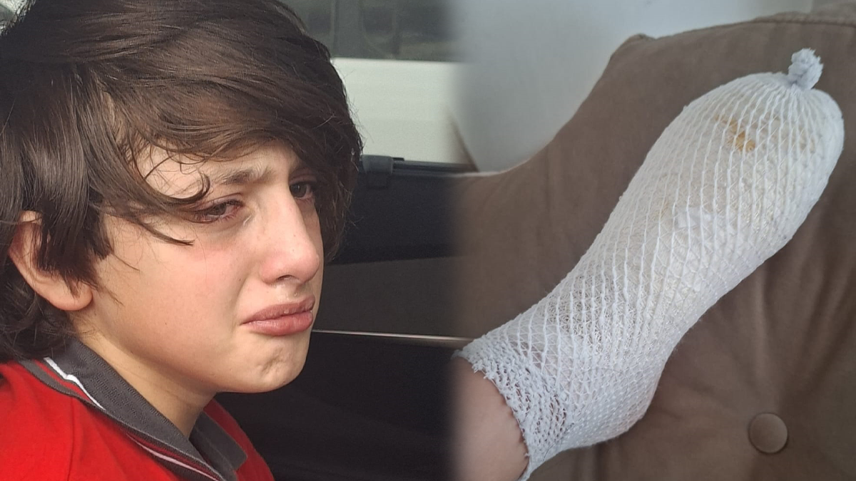 Oyuncak elinde patladı: 11 yaşındaki Furkan'ın ayağı yandı